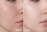 Dr.Nano Micro-Derma Roller