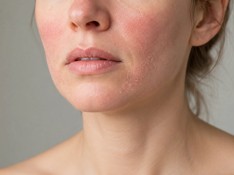 Retinol and acids peel the surface — they don't rebuild what's underneath